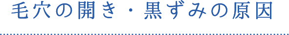 毛穴の開き・黒ずみの原因